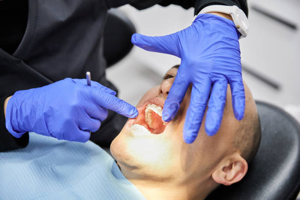 Best Emergency Wisdom Teeth Removal in Rodney Village, DE